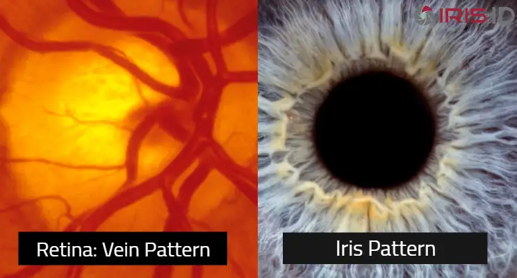 Retina vs. Iris