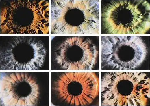 Caractéristiques de l'iris Identification de l'iris